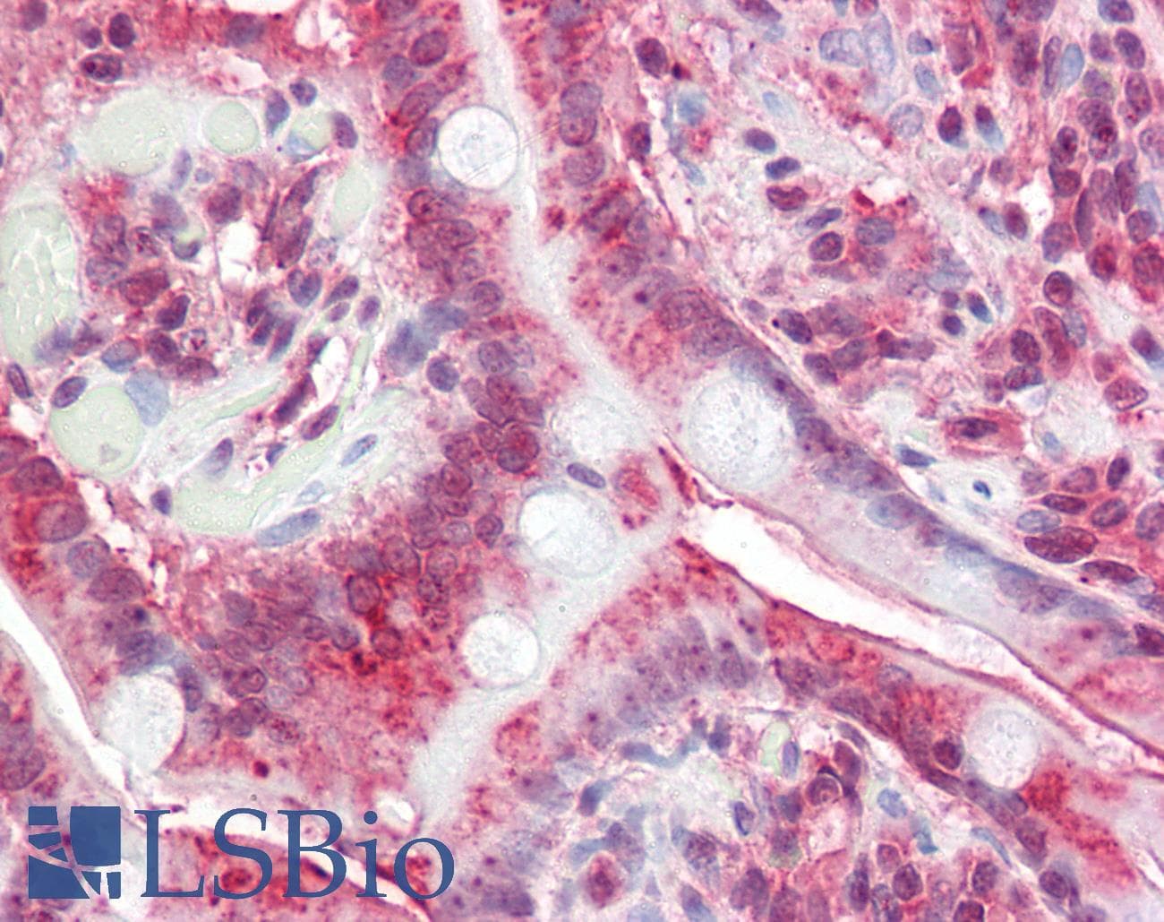 IHC-plus™ TMEM106A Antibody