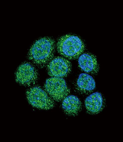 Polyclonal Rabbit anti-Human BTK Antibody (aa209-239, IHC, IF, WB)