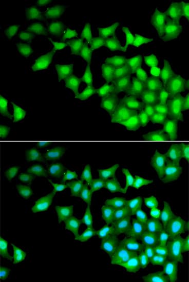 RNGTT / HCAP Antibody