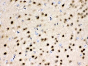 HDAC11 Antibody