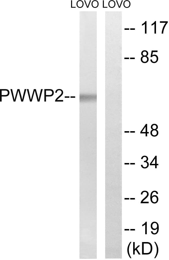Polyclonal Rabbit anti-Human PWWP2B Antibody (aa268-317, WB)