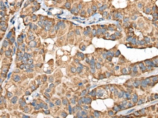 BLNK Antibody