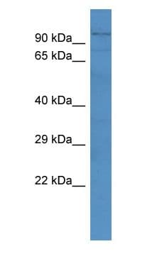 ADAMTS4 Antibody (aa56-105)
