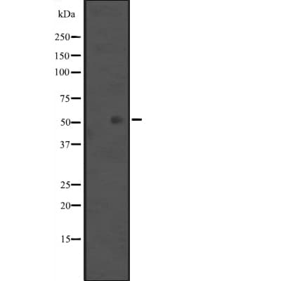 Polyclonal Rabbit anti-Human KRT36 / Keratin 36 / KRTHA6 Antibody (IHC, IF, WB)