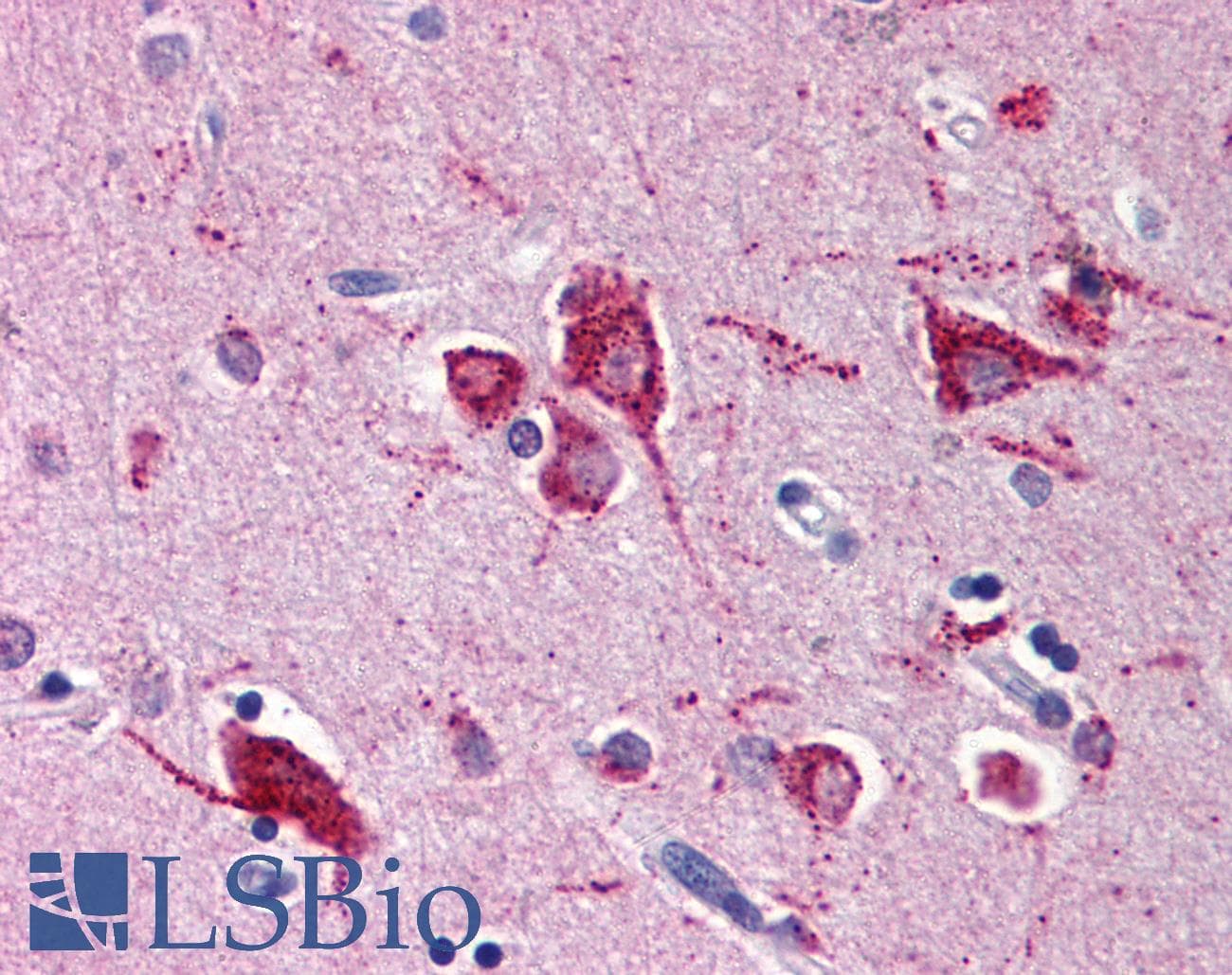 IHC-plus™ RHEB Antibody