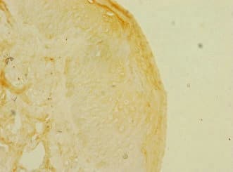 Polyclonal Rabbit anti-Human KREMEN1 / KREMEN-1 Antibody (IHC)