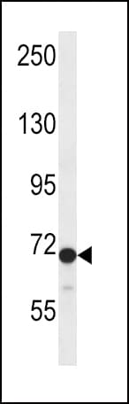Polyclonal Rabbit anti-Human DVL2 / Dishevelled 2 Antibody (aa588-617, WB)