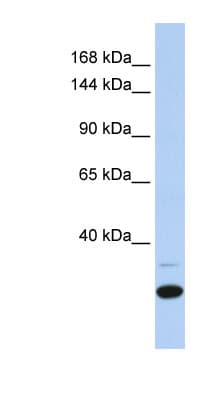 ZNF197 Antibody (N-Terminus)