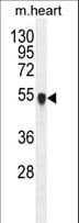 PPM1L Antibody (aa215-244)
