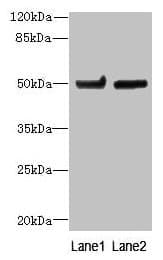 TUBB6 / Tubulin Beta 6 Antibody (aa1-446)