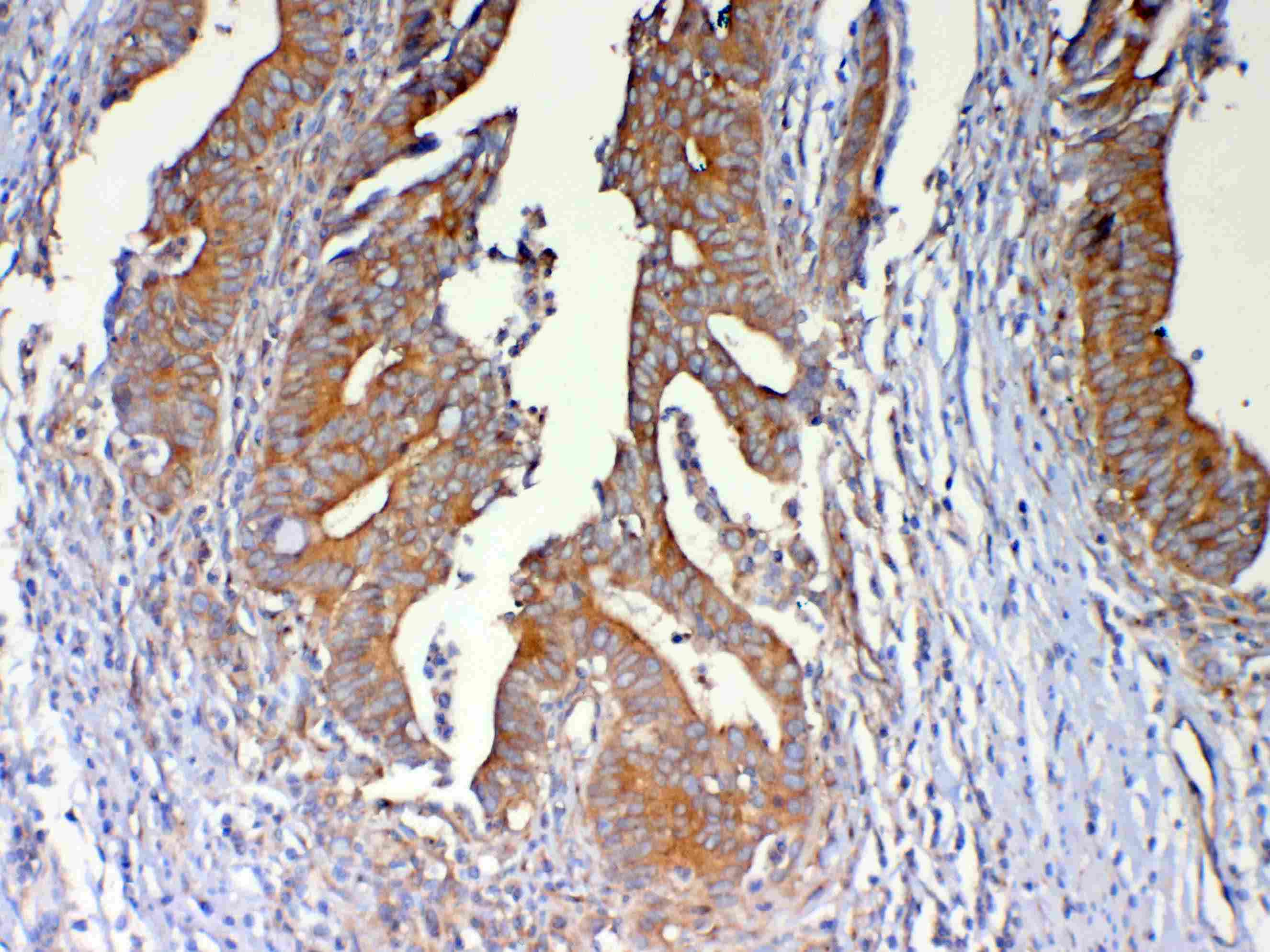 Polyclonal Rabbit anti-Human DYNLT1 / TCTEX-1 Antibody (IHC, WB)