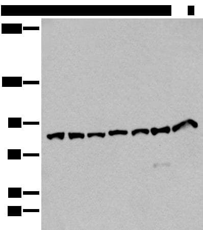 Polyclonal Rabbit anti-Human VPS35 Antibody (IHC, WB)