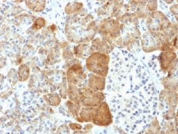 VLDLR Antibody (clone VLDLR/1337)