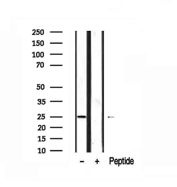 AKIP1 / BCA3 Antibody