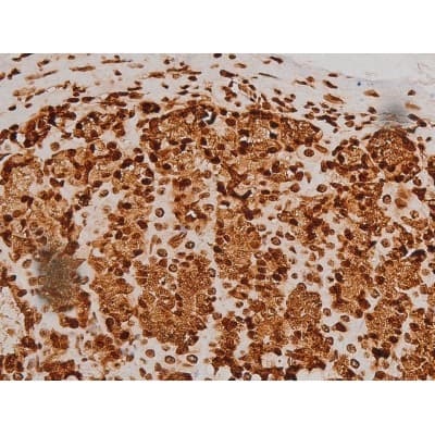 Polyclonal Rabbit anti-Human EZR / Ezrin Antibody (phospho-Tyr353, IF, WB)