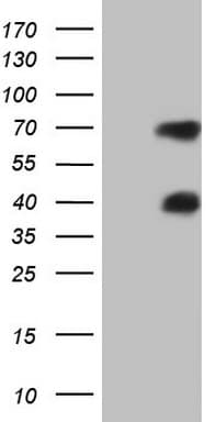 MSLN / Mesothelin Antibody (aa270-493, clone OTI1A6)