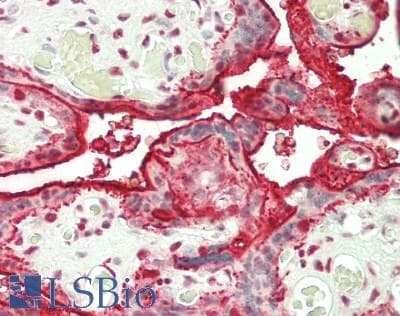 IHC-plus™ PPP1R1B / DARPP-32 Antibody