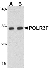 IHC-plus™ POLR3F Antibody
