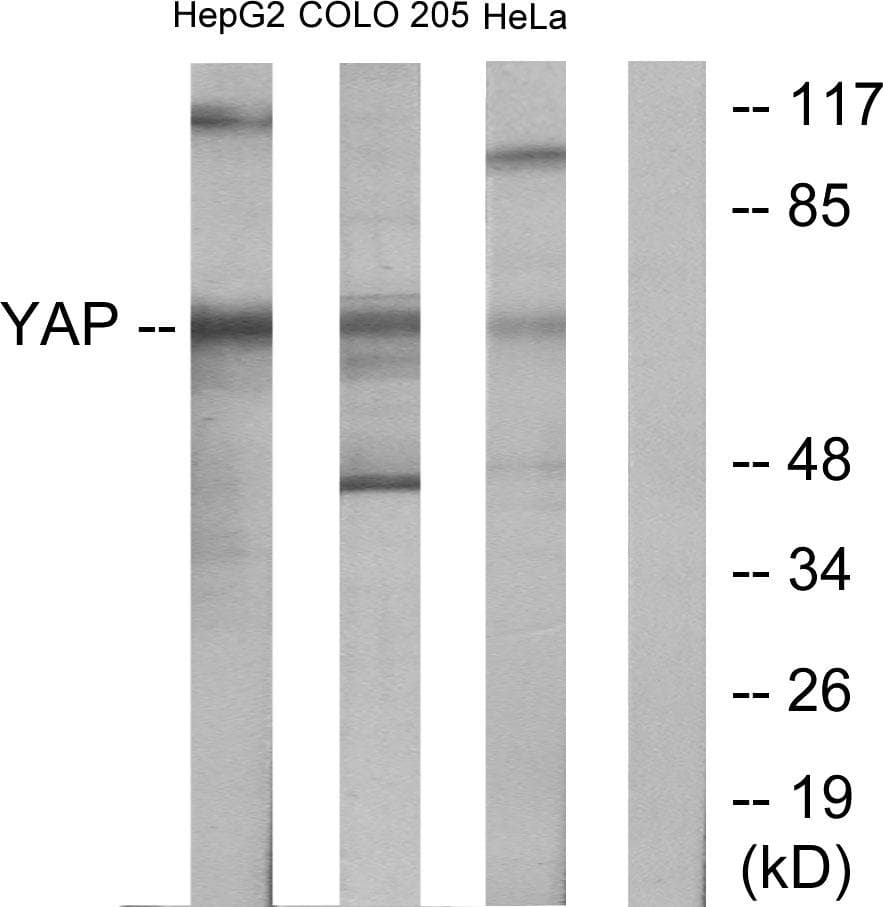 YAP / YAP1 Antibody