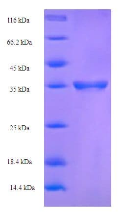 Human CLEC4C / CD303 / BDCA-2 Protein (Recombinant 6His-SUMO, N-terminus)