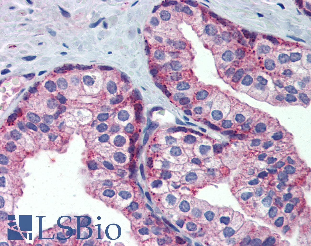 IHC-plus™ MARCH8 Antibody