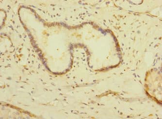 Polyclonal Rabbit anti-Human PALS2 / MPP6 Antibody (IHC)