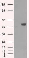PFKFB4 Antibody (clone OTI1C8, Carrier-free)