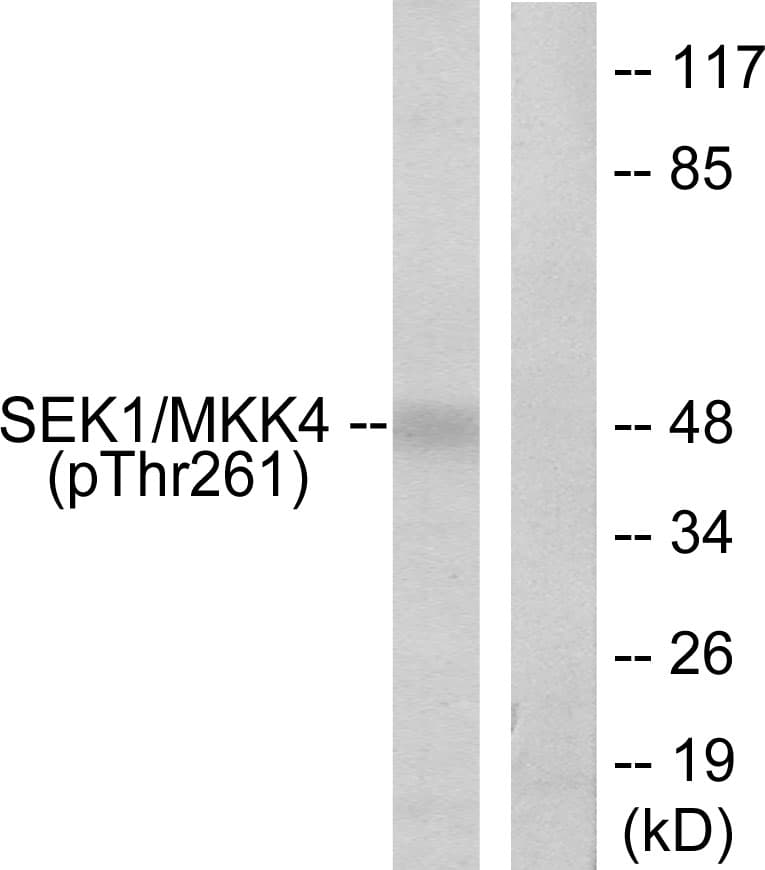 MAP2K4 / MKK4 Antibody (phospho-Thr261)