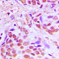 SRF / Serum Response Factor Antibody (Internal)