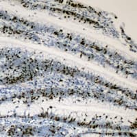Polyclonal Rabbit anti-Human MYC / c-Myc Antibody (C-Terminus, IHC, IF, WB)