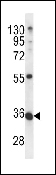 METTL11B Antibody (aa14-42)