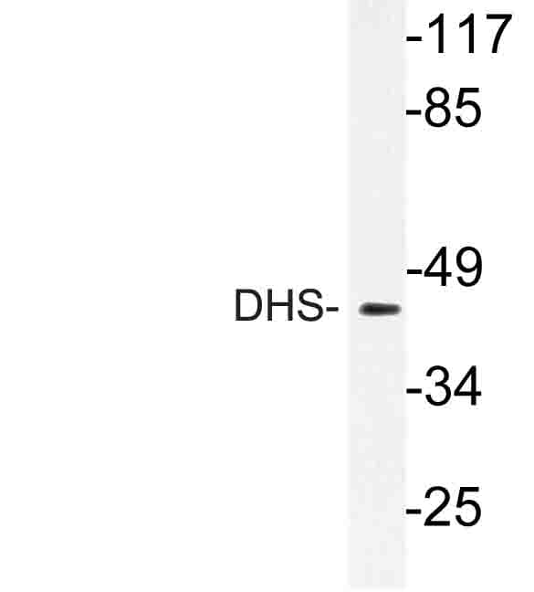 DHPS Antibody (Leu87)
