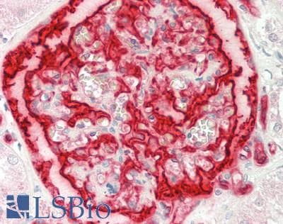 IHC-plus™ SDC2 / Syndecan 2 Antibody (aa81-130)