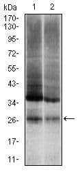 UBB / Ubiquitin B Antibody (clone 3C12)