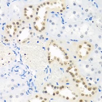 p84 / THOC1 Antibody