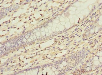 KCND2 / Kv4.2 Antibody