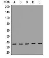 GIPC1 / GIPC Antibody