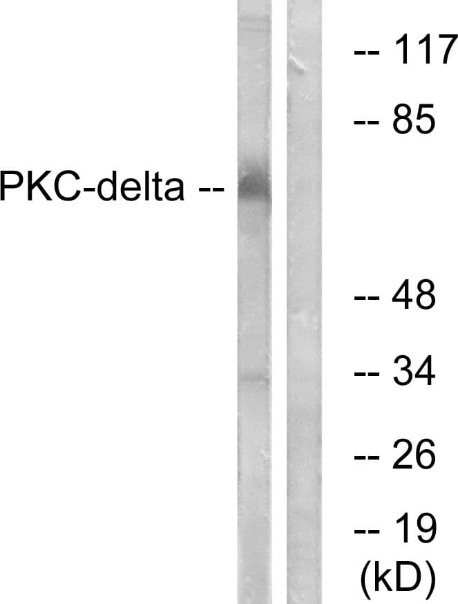 PRKCD / PKC-Delta Antibody (aa612-661)
