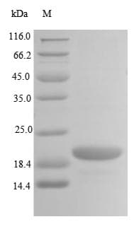Human TRIP12 Protein (Recombinant 10His, N-terminus + Myc, C-terminus)