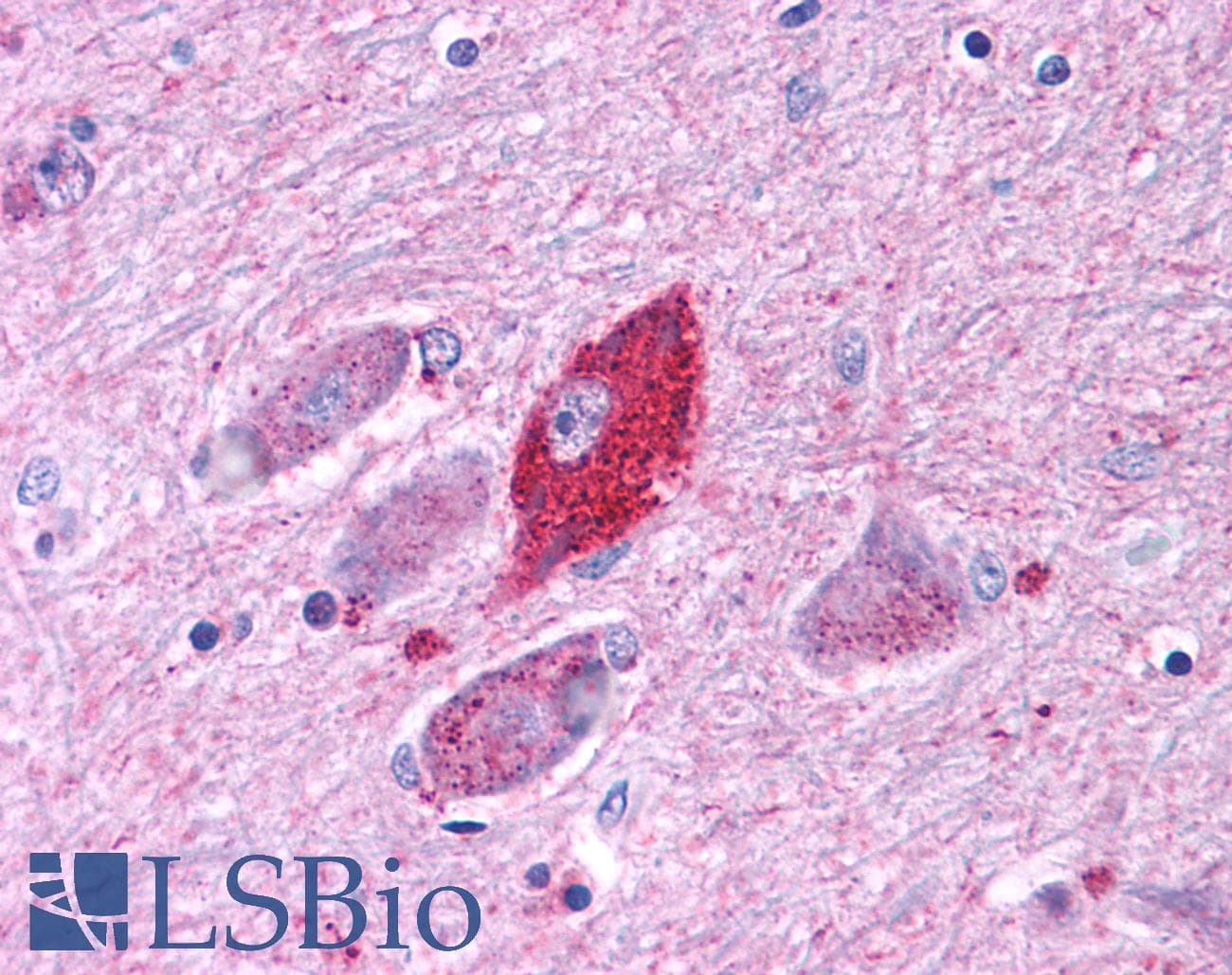 PathPlus™ CRFR1 / CRHR1 Antibody (N-Terminus)