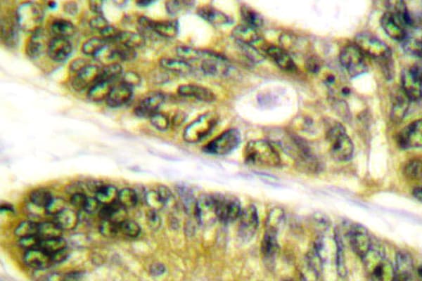 HDAC6 Antibody (His1203)