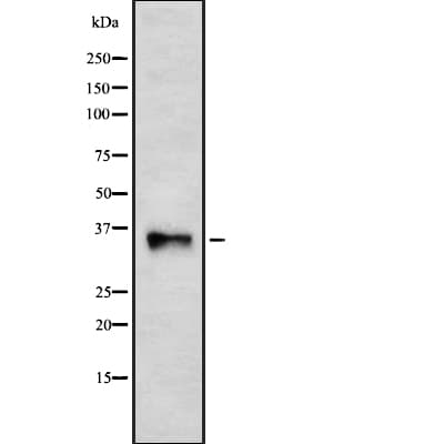 Olfactory Receptor, Family 5, Subfamily BA, Member 1 Pseudogene (OR5BA1P) Antibody
