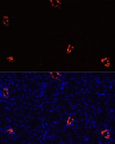AQP2 / Aquaporin 2 Antibody