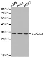 CCL25 / TECK Antibody