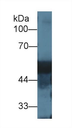 GC / Vitamin D-Binding Protein Antibody (aa395-475)