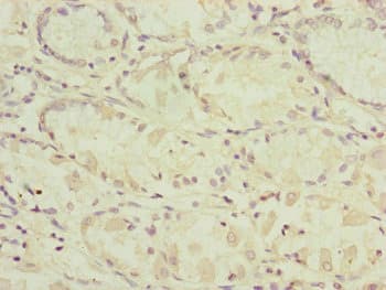 RARS2 / ARGRS Antibody