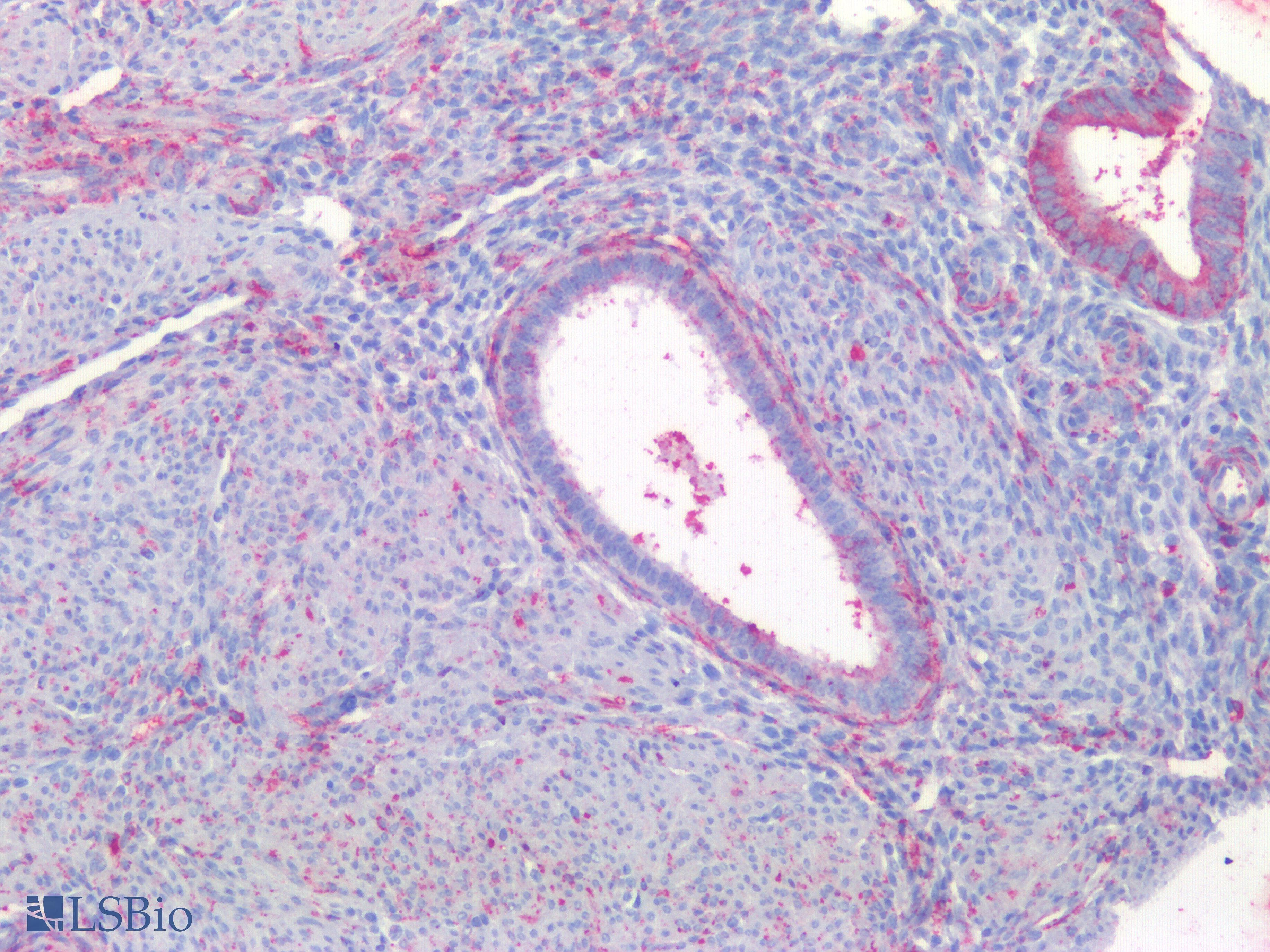 PathPlus™ HAVCR1 / KIM-1 Antibody
