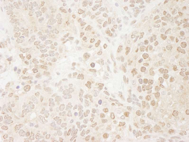 DROSHA / RNASEN Antibody (aa1050-1100)