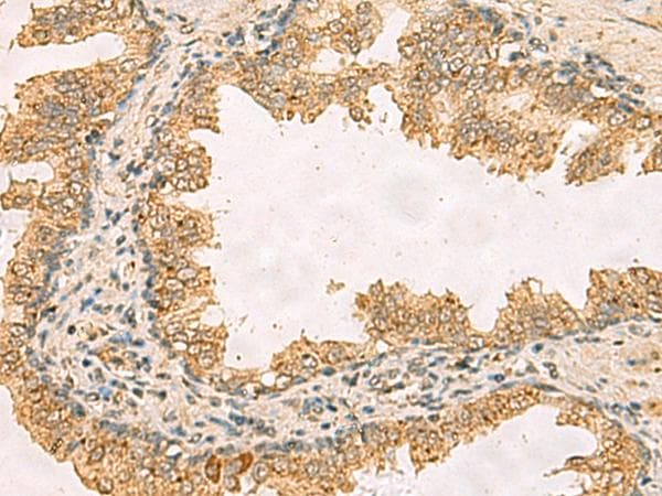 RPS11 / Ribosomal Protein 11 Antibody