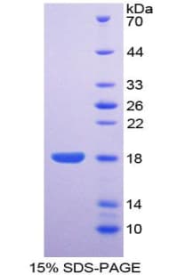 Human ENPP1 Protein (Recombinant His)